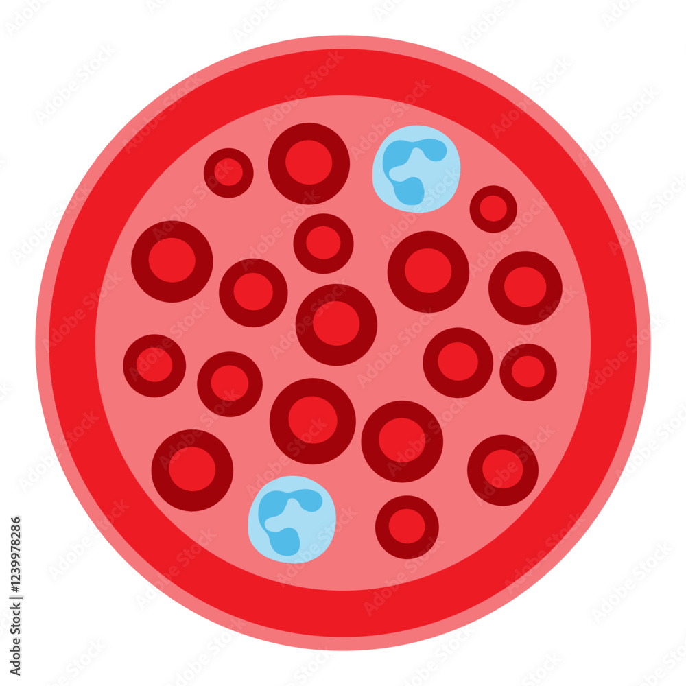 neutropenia neutropenia