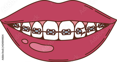Cartoon groovy smiling lips revealing teeth with braces and wires, symbolizing dental care, orthodontics, oral health, medicine and human body, emphasizing corrective treatment and alignment of teeth