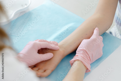 Doctor doing skin allergy test at white table in office. Allergy test - skin prick allergy testing for possible allergens photo