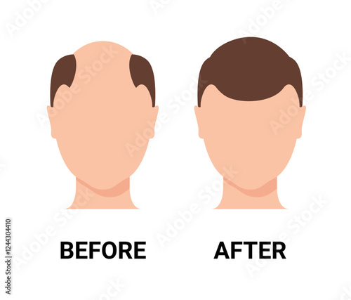 Hair loss man icon cartoon vector logo. Hair loss male scalp bald illustration