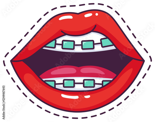 Cartoon illustration featuring vibrant red female lips adorned with braces and a visible tongue, highlighting the importance of dental care and orthodontic treatment for oral health