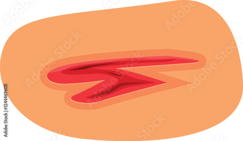 Open bleeding wound on human skin representing injury, trauma, or medical condition