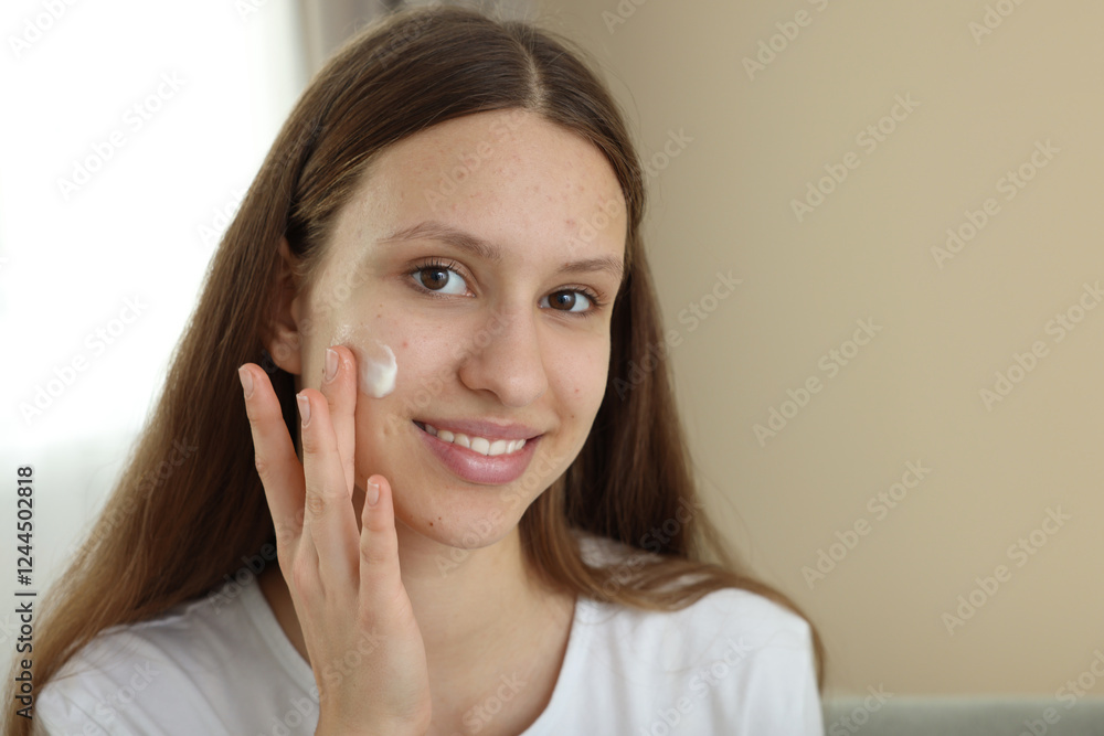 Teenage girl applying cream onto face at home, space for text. Acne treatment Teenage girl applying cream onto face at home, space for text. Acne treatment
