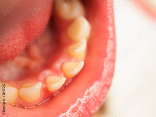 Wallpaper Mural Milk bite and tooth change in children, the process of tooth growth and change in early childhood. Torontodigital.ca