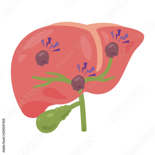 肝臓がんになった肝臓のイラスト2