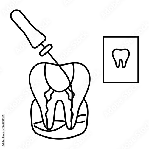 Endodontic therapy Root canal treatment Concept, dental examination with Probe and Repair cavities vector icon design, Dentistry symbol, Healthcare sign, Dental instrument illustration