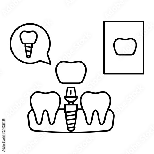 Replacing one Missing Teeth using Dental Implant Concept, permanent fixed dentures replacement vector icon design, Dentistry symbol, Healthcare sign, Dental instrument illustration