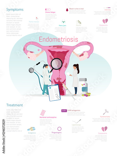 Medical illustration displaying symptoms and treatment options for endometriosis, including medication, surgery, and hormonal therapies.