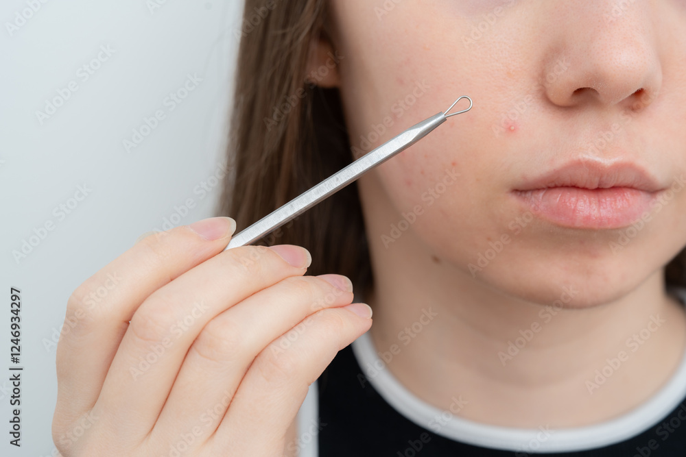 Young woman holding pimple removal tool near face showing pimple on a cheek. Pimple extractor. Inflamed acne and post-acne marks, redness. Hormonal acne treatment, puberty, adult acne. Selective focus Young woman holding pimple removal tool near face showing pimple on a cheek. Pimple extractor. Inflamed acne and post-acne marks, redness. Hormonal acne treatment, puberty, adult acne. Selective focus
