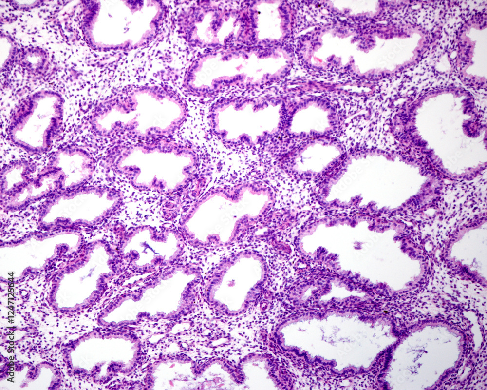 Fotografie Human endometrium. Secretory phase