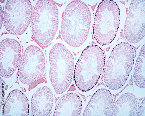 Testicle.Spermatogenesis. BrdU labelling photo