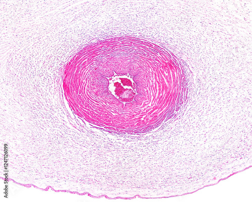 Umbilical cord artery photo