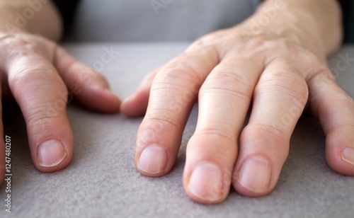 Cuadro en lienzo hand osteoarthritis
