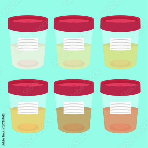 Urine test color chart