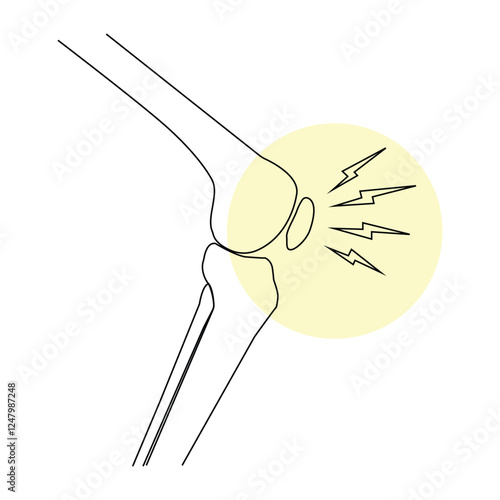 Leg bones and knee joint cartilage inflammation on blue background Human skeleton anatomy. Medical health care science vector