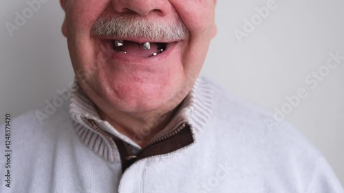 A toothless smile on an elderly man. preparation for prosthetics
