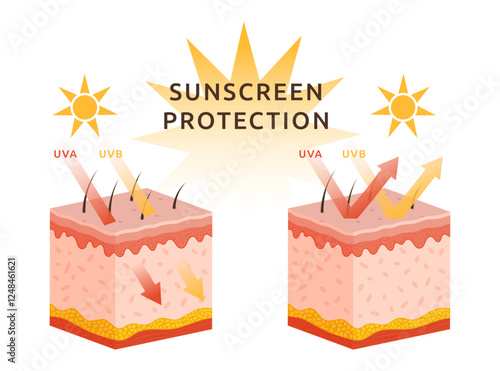 Protect skin from UV sun. Rays arrow damage. UVA and UVB reflecting heat. Structure of layer epidermis. Human body. Dermis section chart. Sunscreen protection infographic. Vector garish illustration