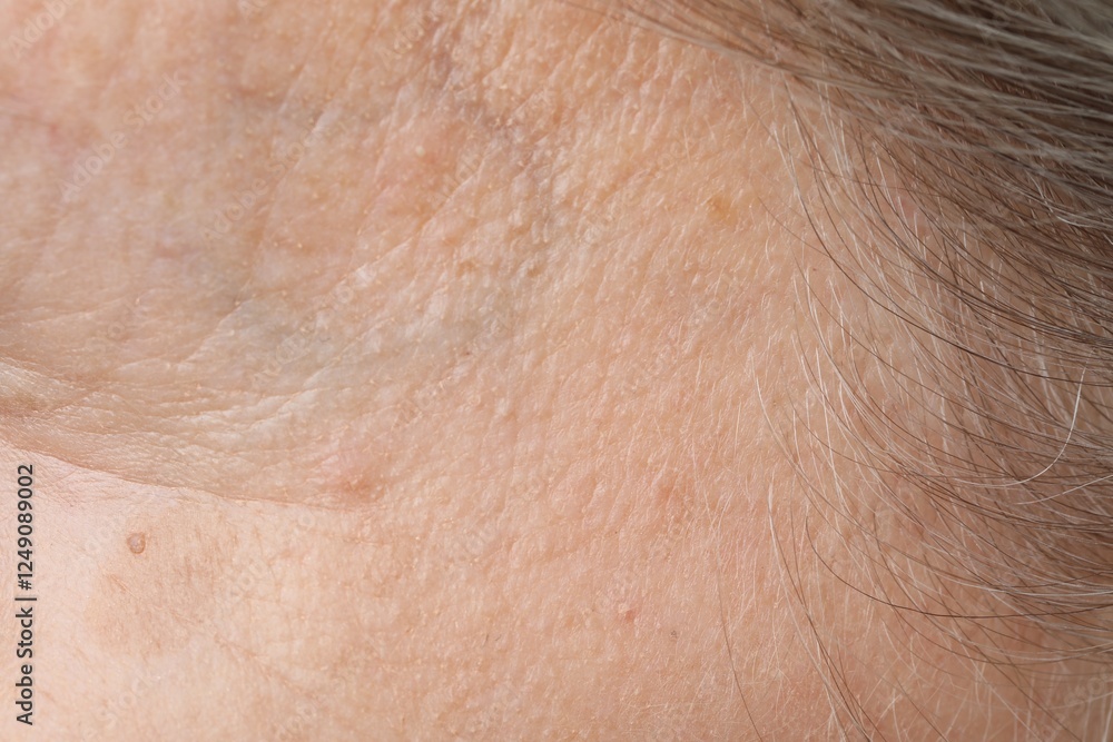 Macro view of dry skin as background Macro view of dry skin as background