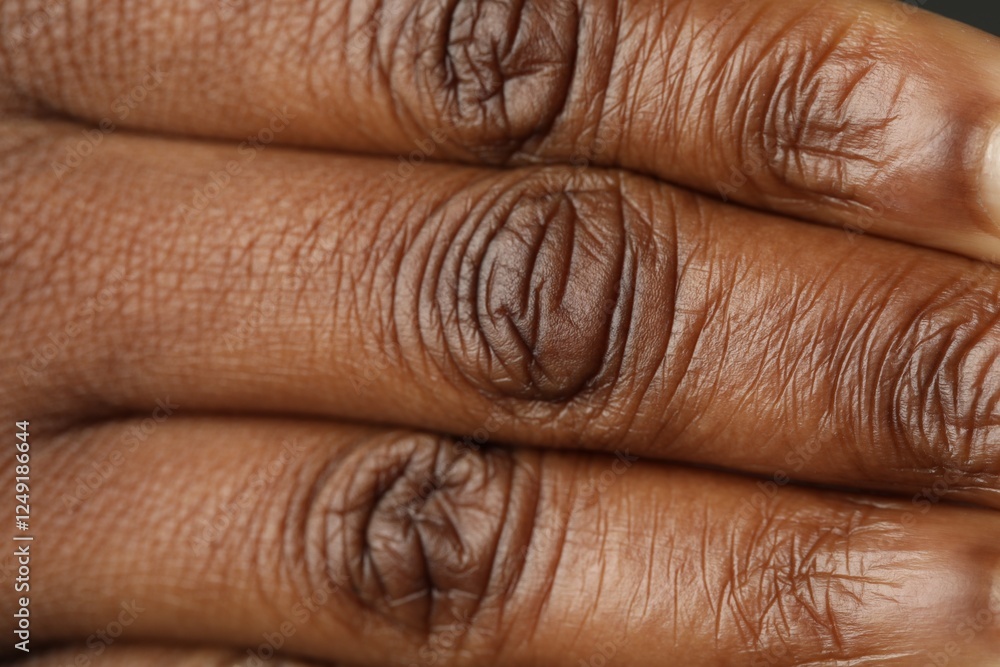 Macro view of normal skin as background Macro view of normal skin as background