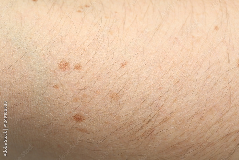 Fototapeta premium Texture of normal skin as background, closeup