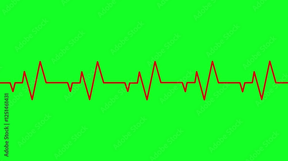 Heart rate ekg monitor in hospital theater. Medical vital signs monitor instrument in a hospital on anesthesia surgery monitor. ECG. Patient heartbeat at the screen animation Heart rate ekg monitor in hospital theater. Medical vital signs monitor instrument in a hospital on anesthesia surgery monitor. ECG. Patient heartbeat at the screen animation