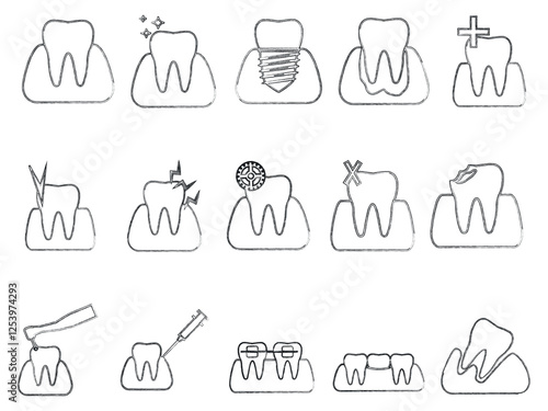 This is a collection of black and white teeth icons representing various dental diseases and treatments. Icons represent healthy teeth, tooth decay, tooth decay, braces, extractions, fillings, implan