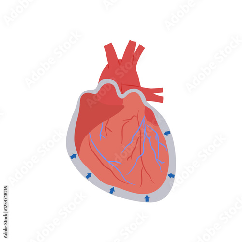 Pericardial disease, Cardiovascular Disease Illustration Icon