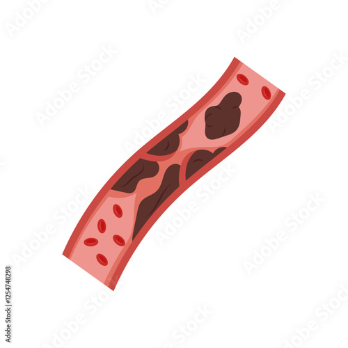 Deep Vein Thrombosis, Cardiovascular Disease Illustration Icon
