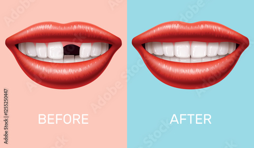 Woman mouth without tooth. Teeth implantation. Realistic woman mouth, smile before and after. Prosthetics in stomatology clinic. Dental medicine, molar 3d isolated vector healthcare concept