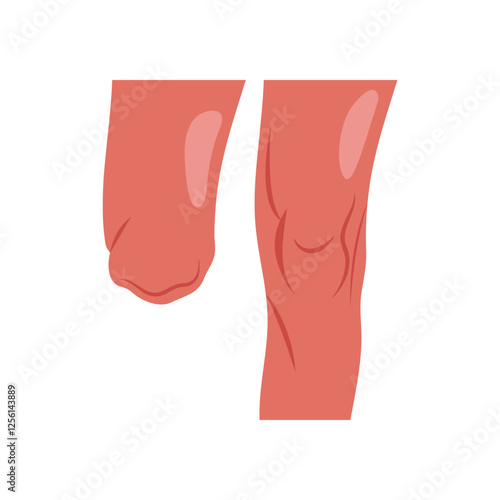 Leg Amputated, Disability Vector Illustration Isolated