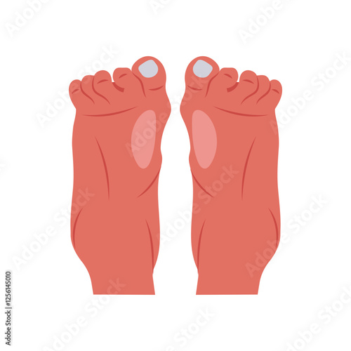 Arthritis, Foot, Disability Vector Illustration Isolated