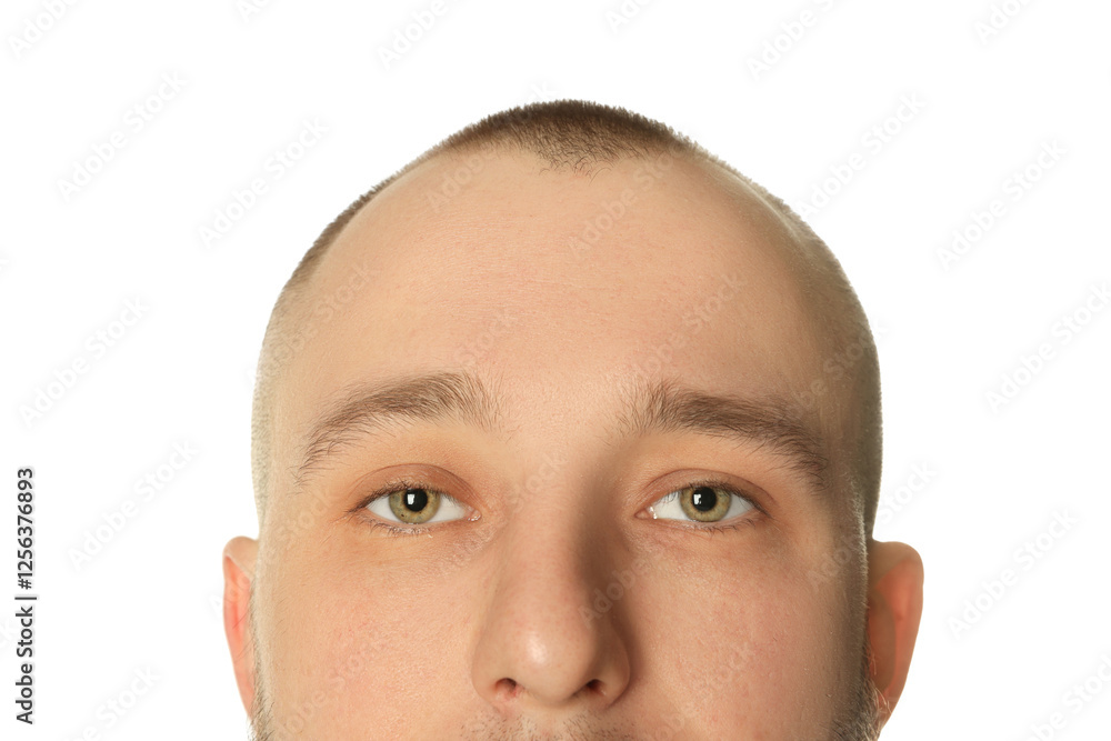 Fototapeta premium Baldness problem. Man with receding hairline on white background, closeup