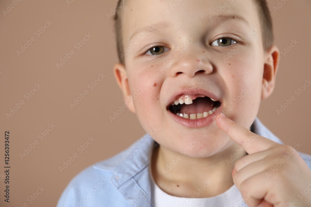 Cute little boy pointing at his missing tooth on dark beige background, closeup. Space for text Cute little boy pointing at his missing tooth on dark beige background, closeup. Space for text