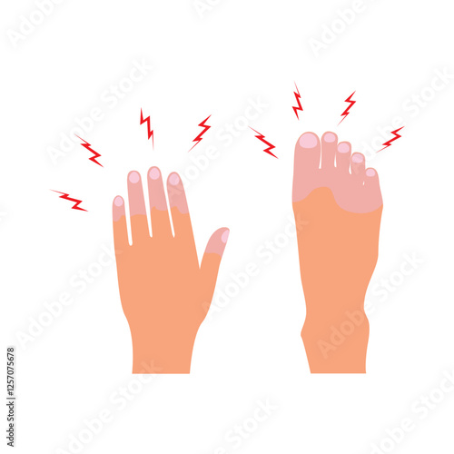 Cold and numbness at the fingertips. Vector illustration of feet and hands.