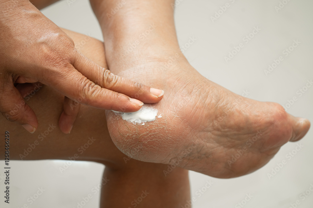 Fototapeta premium Asian woman applying moisturizing cream skincare treatment to solve and repair feet with crack and dry heel skin.