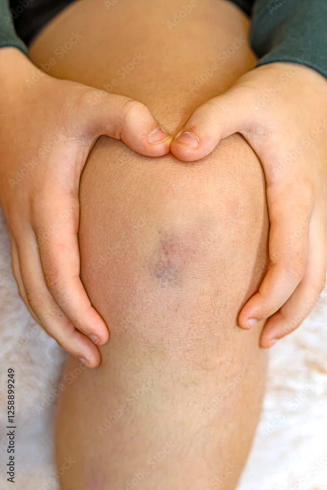 Child with a blow to the knee. Child with a blow to the knee.