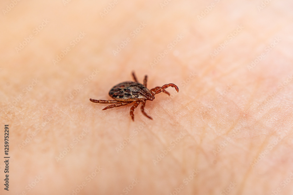small brown insect mite crawls on human skin causing the risk of infection various infectious diseases such as encephalitis, Lyme disease small brown insect mite crawls on human skin causing the risk of infection various infectious diseases such as encephalitis, Lyme disease