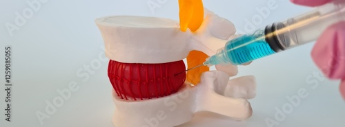 Konstfotografi Model of the human spine on in doctor uses a syringe to make an injection blocka