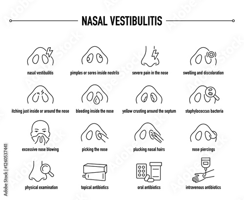 Nasal Vestibulitis symptoms, diagnostic and treatment vector icon set. Line editable medical icons