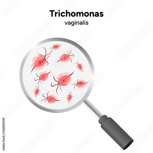 Trichomonas Vaginalis parasites zoom. Men and women infection disease 