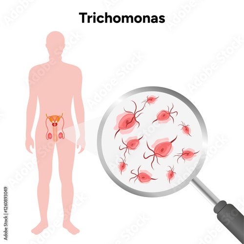 Trichomonas Vaginalis parasites zoom. Men and women infection disease 