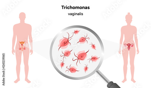 Trichomonas Vaginalis parasites zoom. Men and women infection disease 