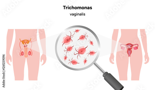Trichomonas Vaginalis parasites zoom. Men and women infection disease 