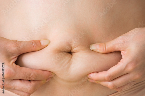 woman squeezes her belly fat