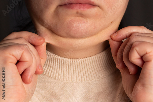 Close up image of female second chin. Overweight woman demonstrating second chin. Weight excess problem. Double chin correction surgery concept. photo