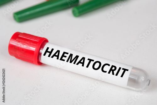 Haematocrit name of blood test photo