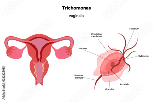 Trichomonas Vaginalis parasites zoom. Men and women infection disease 