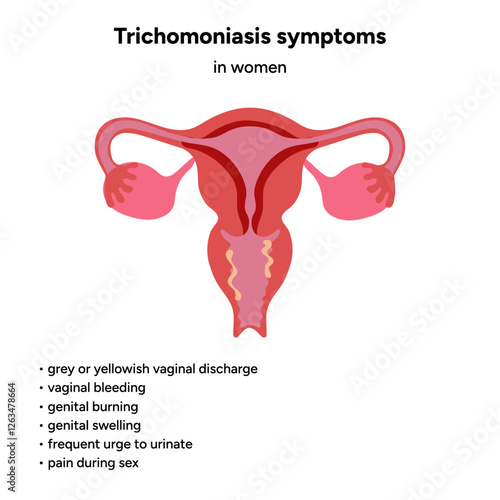 Trichomonas Vaginalis parasites zoom. Men and women infection disease. Trichomonas symptoms in woman