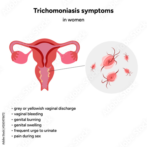Trichomonas Vaginalis parasites zoom. Men and women infection disease. Trichomonas symptoms in woman