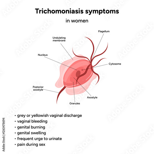 Trichomonas Vaginalis parasites zoom. Men and women infection disease. Trichomonas symptoms in woman